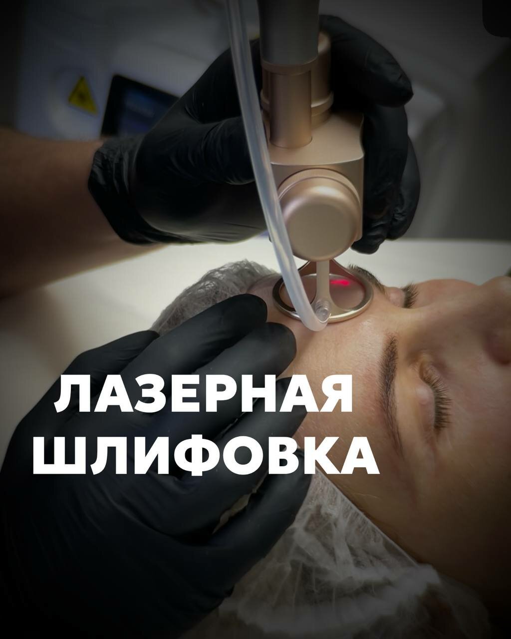 Лазерная процедура в студии